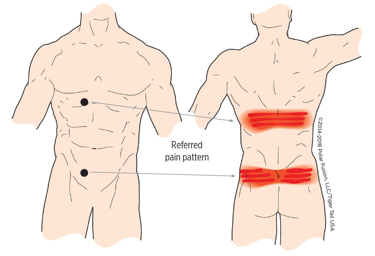 Rectus Abdominis